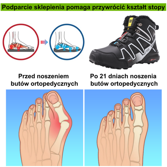 ⚡Ograniczona czasowo zniżka 50%🔥 — Ergonomicznie zaprojektowane buty ortopedyczne, które łagodzą ból stóp, pleców i stawów;