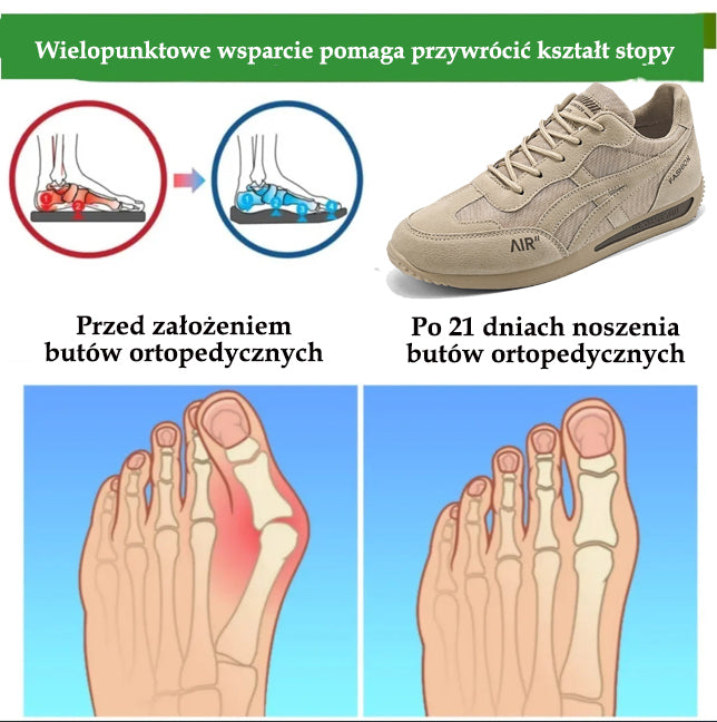 OARONE® | Nowość na rynku – przez ograniczony czas za pół ceny. Ergonomiczna konstrukcja, doskonała amortyzacja i korekcja chodu.