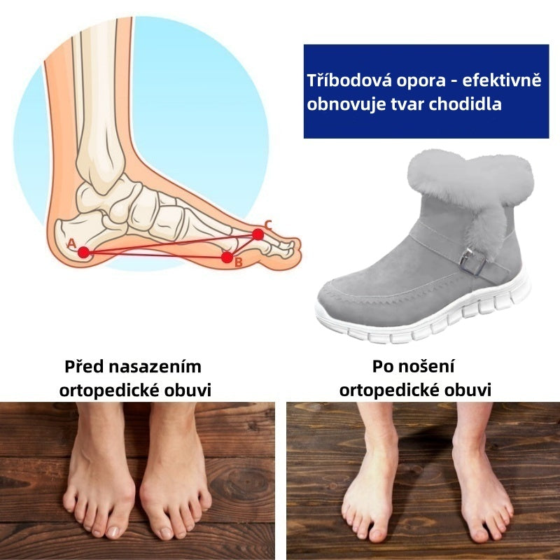 Oarone®|  Ergonomicznie ukształtowane zimowe buty ortopedyczne łagodzące ból stóp, kolan i pleców - Damskie