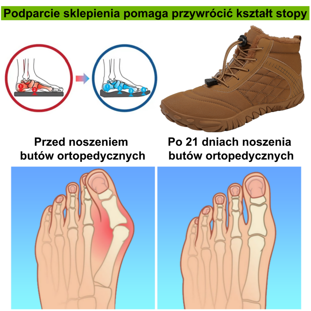 【⏰Oferta ograniczona czasowo: 70% zniżki - Nie przegap】Najnowsze ergonomiczne wełniane buty zimowe - ✅️ Korygują postawę podczas chodzenia - Zwiększają ciepło, wodoodporność i antypoślizgowość👞