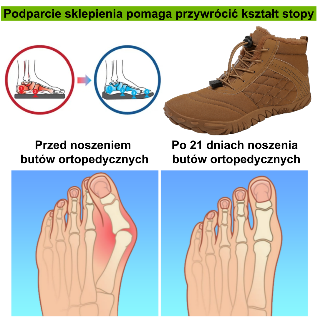 【⏰Oferta ograniczona czasowo: 70% zniżki - Nie przegap】Najnowsze ergonomiczne wełniane buty zimowe - ✅️ Korygują postawę podczas chodzenia - Zwiększają ciepło, wodoodporność i antypoślizgowość👞
