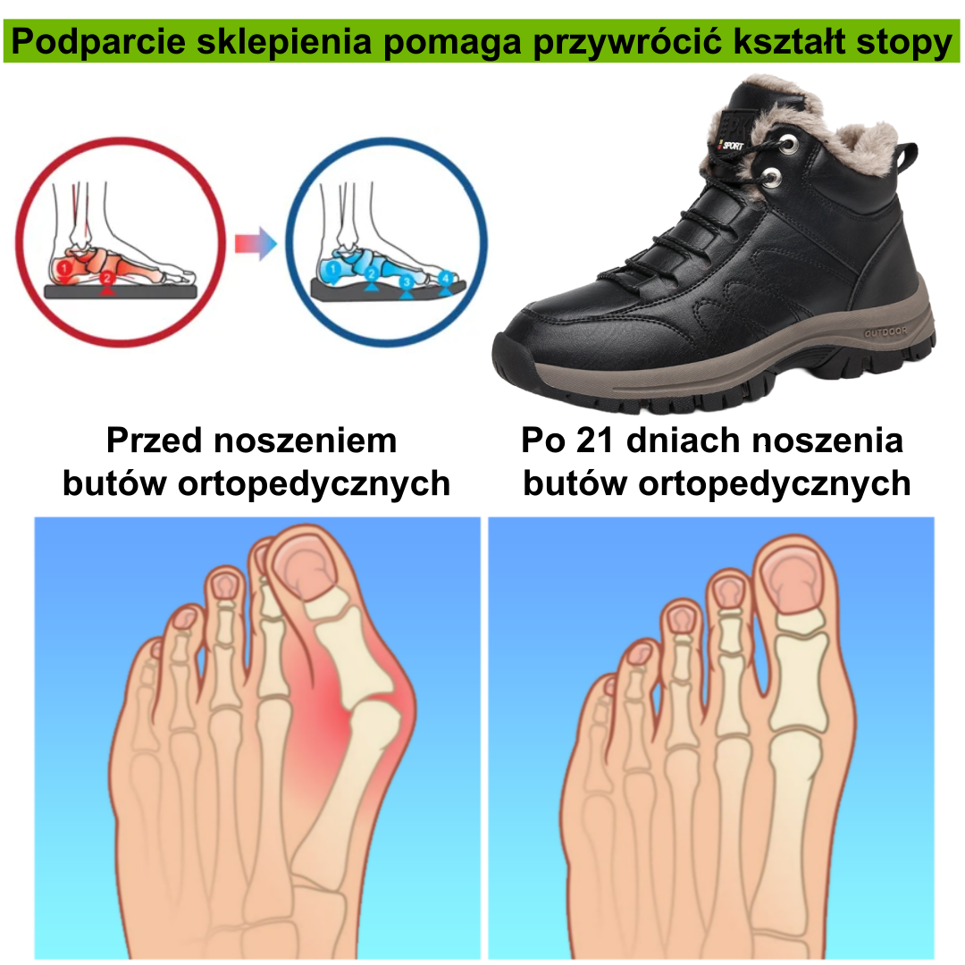 ⚡Ograniczona czasowo zniżka 50%🔥 — Ergonomicznie zaprojektowane buty ortopedyczne, które łagodzą ból stóp, pleców i stawów;