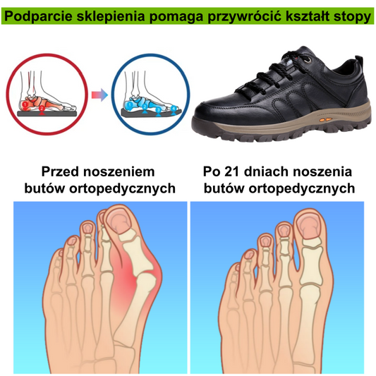 ⚡Ograniczona czasowo zniżka 50%🔥 — Ergonomicznie zaprojektowane buty ortopedyczne, które łagodzą ból stóp, pleców i stawów;